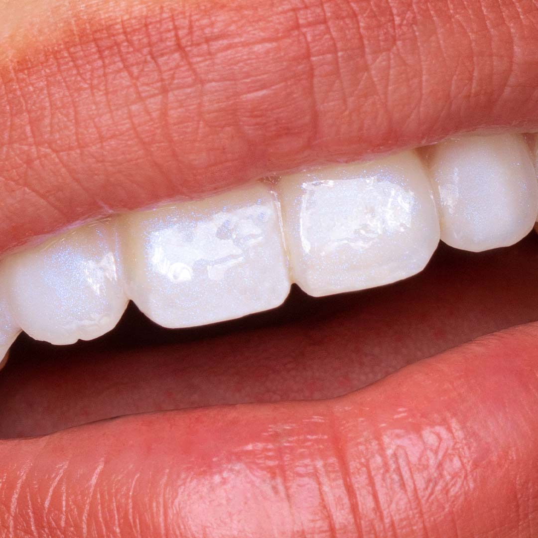 Hismile Glostik Tooth Gloss - Image 4